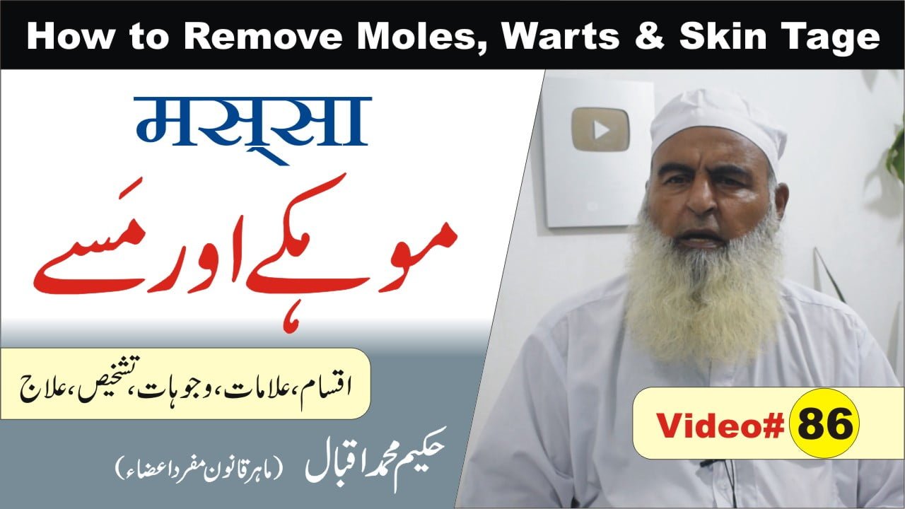 موہکے مسے
