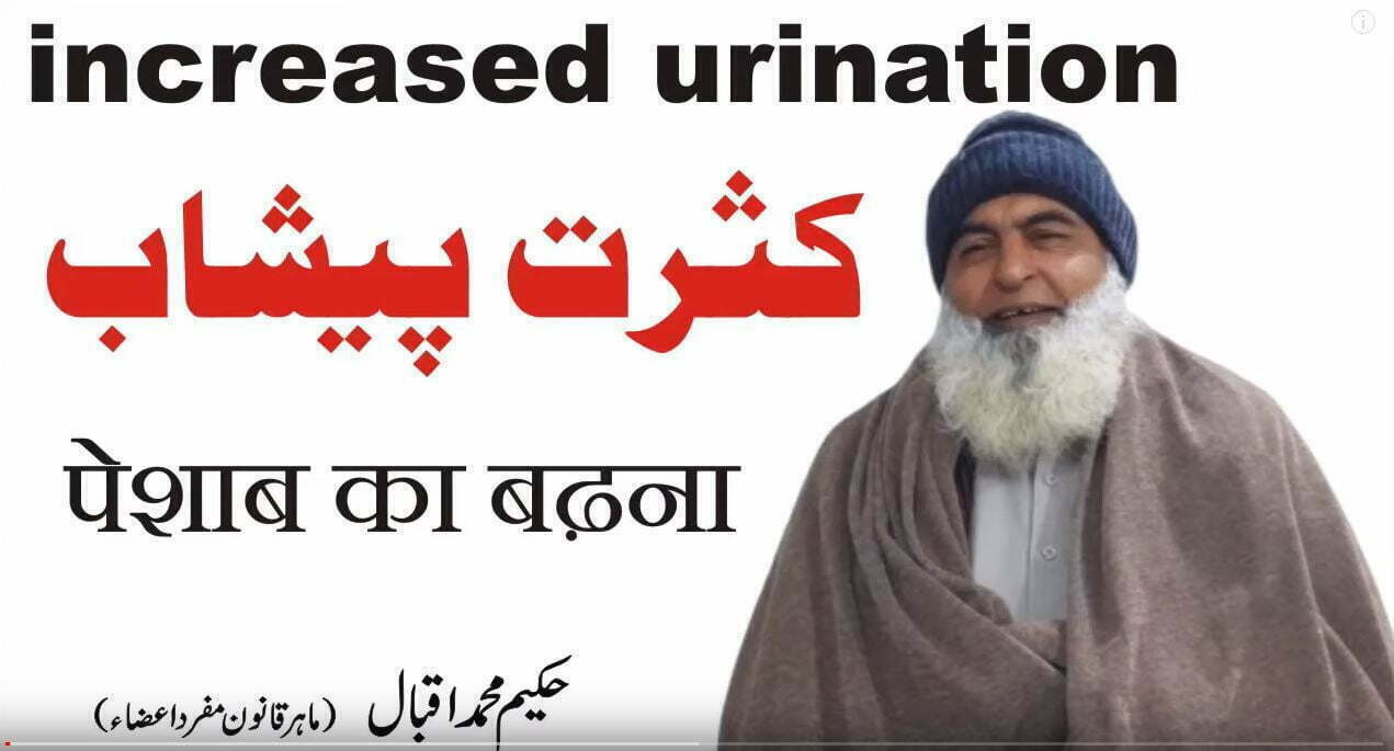 کثرت پیشاب